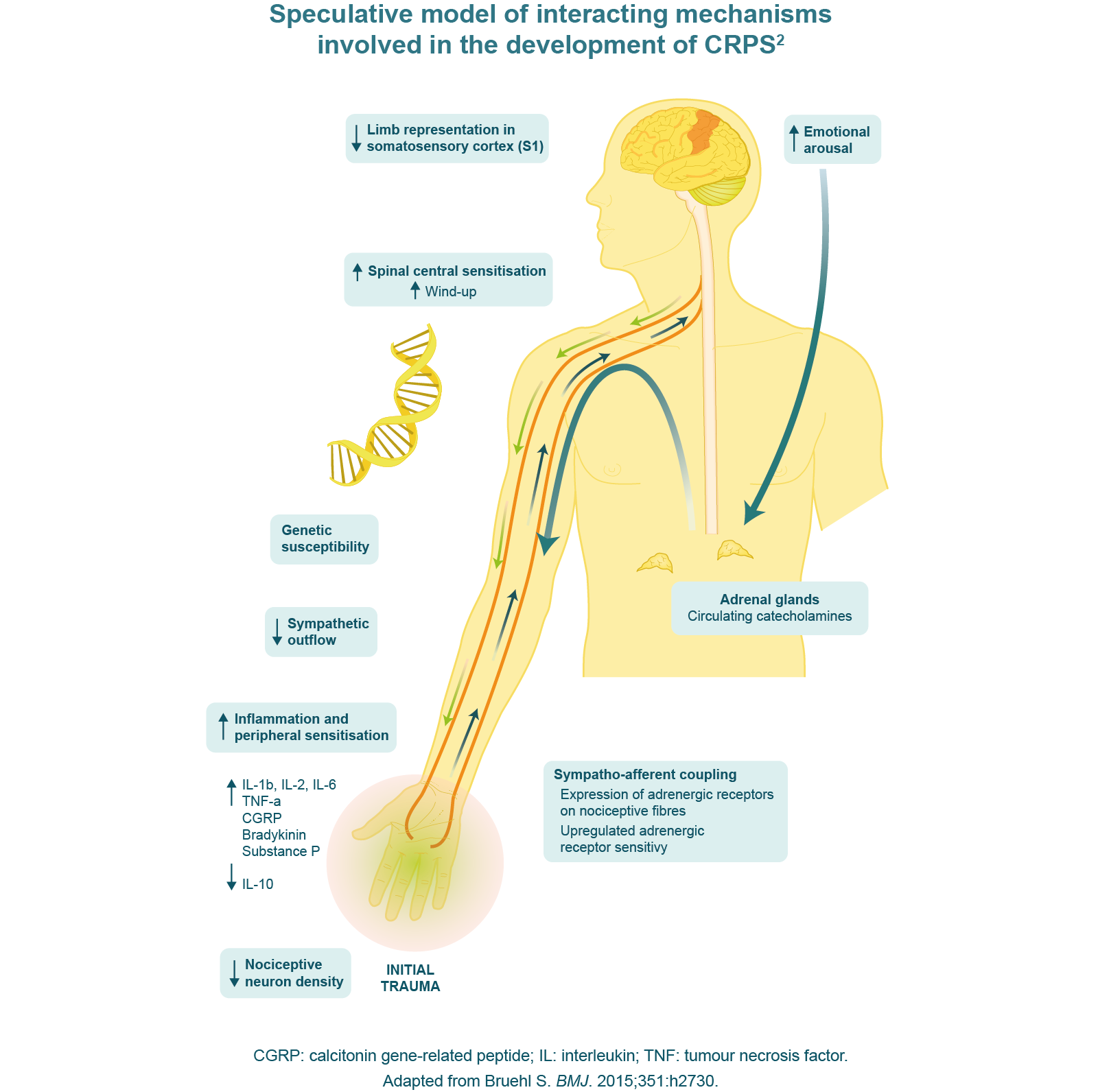 Speculative model of interactive mechanisms involved in the development of CRPS